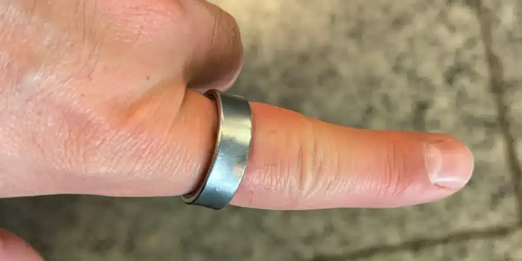 Peligro Anillos Inteligentes Pueden Aplastar Tus Dedos